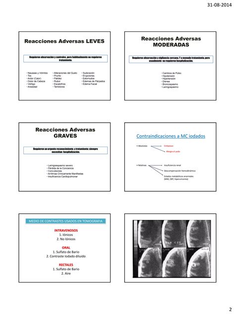 Reacciones Adversas Al Medio De Contraste PDF Descarga Gratuita