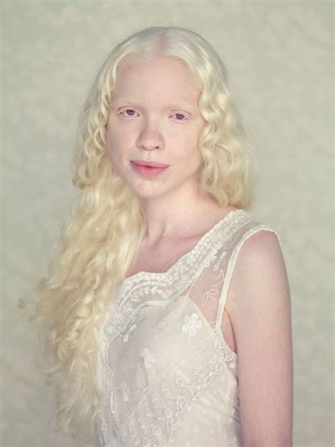 58 Albino People Wholl Mesmerize You With Their Otherworldly Beauty Albino Girl Albino Human