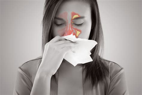 Are Sinus Infections Contagious Dr Madison Richardson F A C S