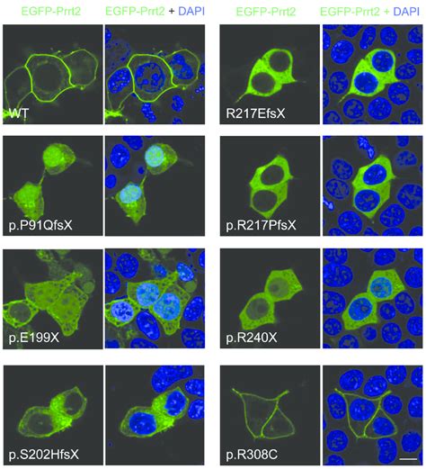 Subcellular Localization Of Pkd Related Prrt Mutations In Cultured