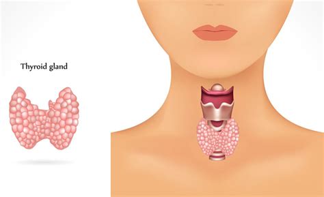 Thyroid Gland Function Disorders Thyroid Clinic Sydney