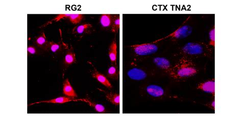 Neural Progenitors Marker Antibody Panel IRAP5015 IReal