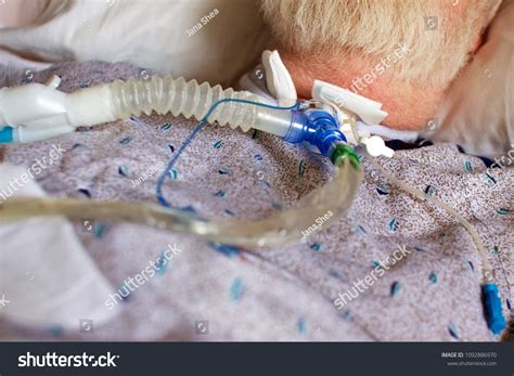 Detail Man Tracheostomy Connected Ventilator Stock Photo 1092886970