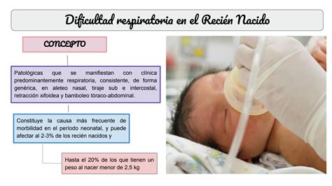 SOLUTION Sindrome De Dificultad Respiratoria En El Recien Nacido Pptx