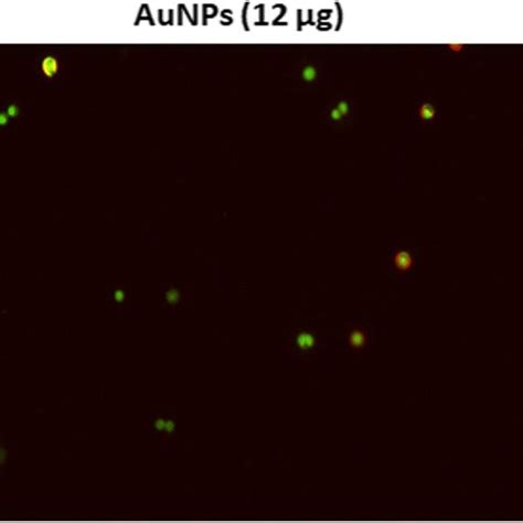 Mitochondrial Membrane Potential Analysis By Jc 1 Staining The Ht 29