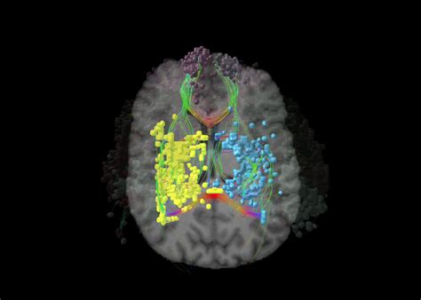 The Limbic System