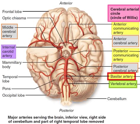 Basilar Artery Anatomy Aneurysm Thrombosis Hypoplasia