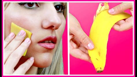 I Rubbed Banana Peels On My Face And My Pimples Disappeared Remove Pimples Using Bananas Youtube