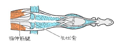 手指伸筋腱損傷（しゅし しんきんけん そんしょう） 福岡の弁護士による後遺障害・等級認定サポート