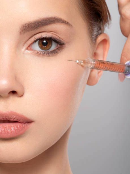 Botox facial Te contamos todo lo que tenés que saber Marie Claire