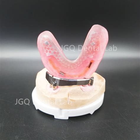 Medical Dental Implant Products Zirconia Crown And Bar Titanium Alloy