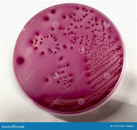 E. Coli Bacteria Growing On The Plate Royalty-Free Stock Image ...