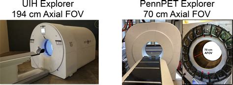 The Potential Role Of Total Body Pet Imaging In Assessment Of