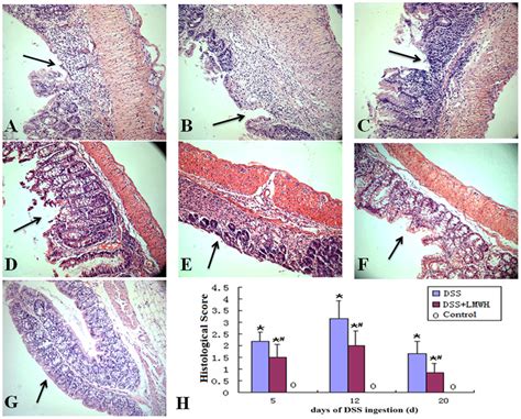 Histological Analyses Of The Colonic Tissues The Distal Ends Of The Download Scientific