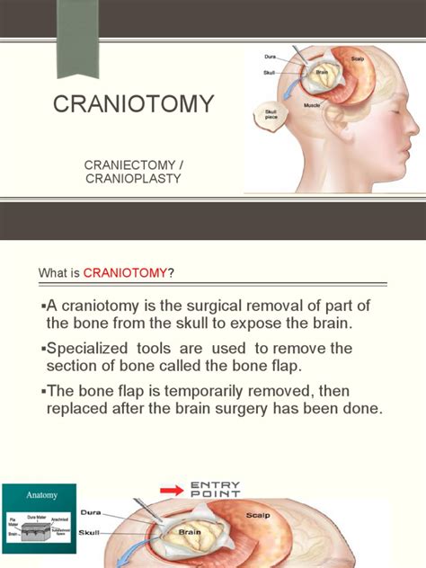 Craniotomy | PDF | Surgery | Clinical Medicine