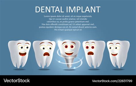 Dental Implant Poster Or Banner Template Vector Image