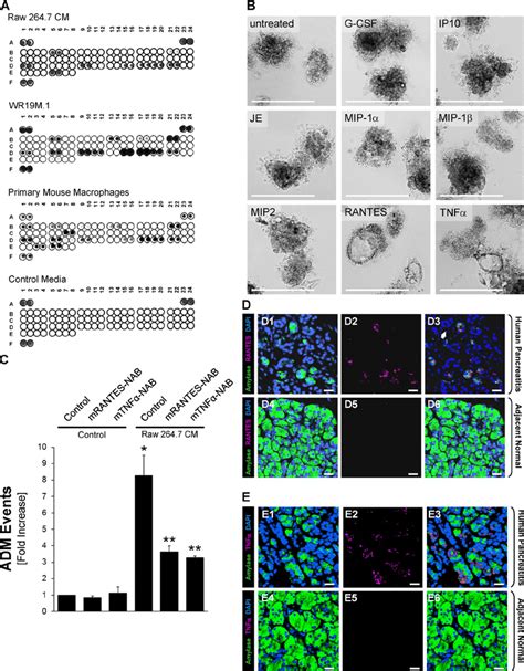 Macrophage Secreted Factors Rantes And Tnf Mediate Adm A Conditioned Download Scientific