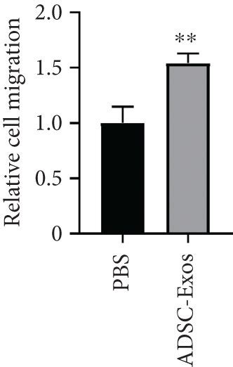 ADSC Exos Can Enhance DRG Neurite Outgrowth And Proliferation And