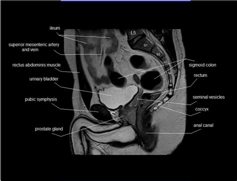 Male Reproductive System Sagittal