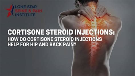 How Do Cortisone Steroid Injections Help For Hip And Back Pain