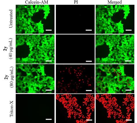 Fluorescence Microscopy Images Of HEK Cells Under Different Conditions