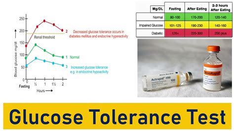 Glucose Tolerance Test Hypoglycemia