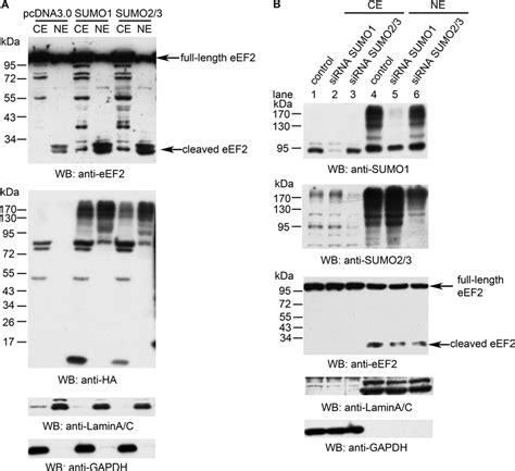 Effect Of Sumoylation On The Cleavage Of Eef2 A Hela Cells Were