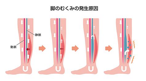 冷房を使い始めると気になる足のむくみ。上手な解消方法は？季節・暮らしの話題 2019年06月26日 日本気象協会 Tenkijp