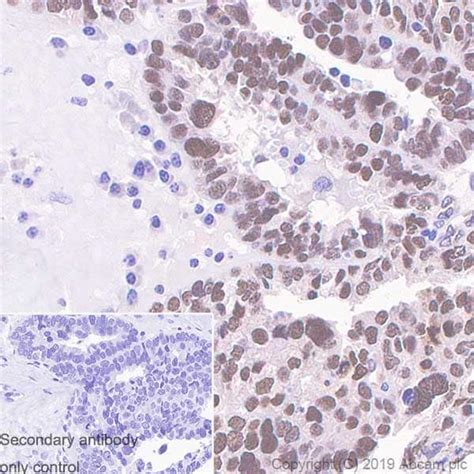 Wilms Tumor Protein重组抗体[sp321] Wilms Tumor Protein抗体 Ab224806