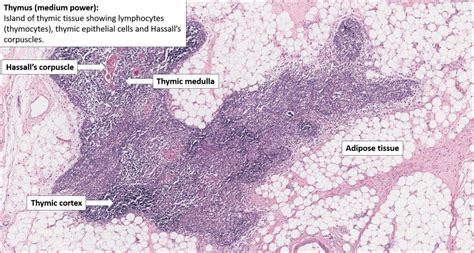 Thymus – Normal Histology – NUS Pathweb :: NUS Pathweb