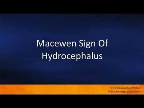 Pronunciation of the word(s) "Macewen Sign Of Hydrocephalus". - YouTube