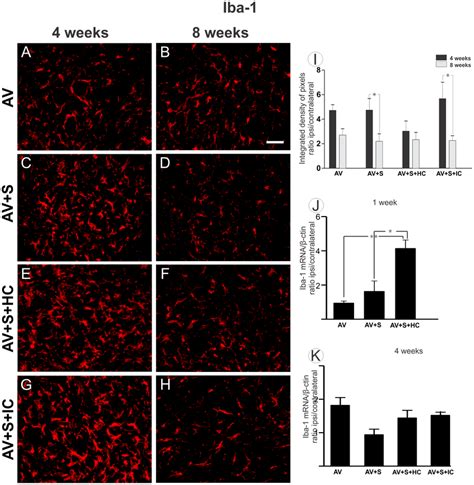 Microglial Analysis Of The Spinal Cord Ventral Horn 4 And 8 Weeks After