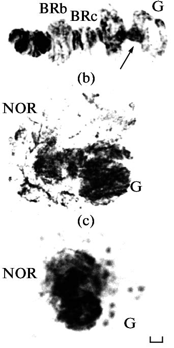 Chromosome G Of Chironomus Riparius Mg A Brb Brc—different