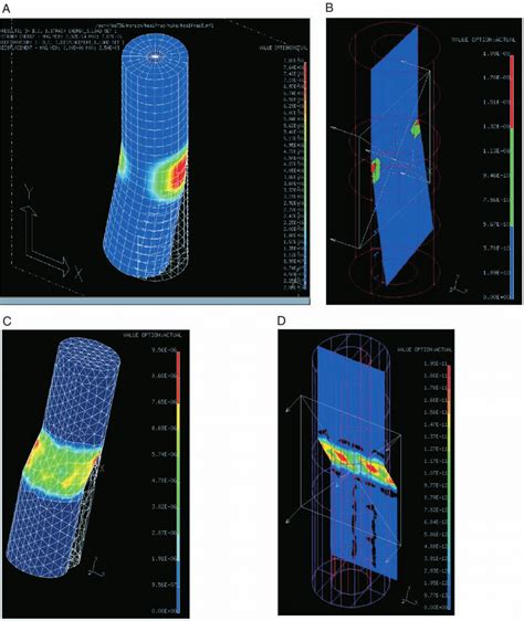 Finite Element Models Fems Illustrating Strain Distribution Within