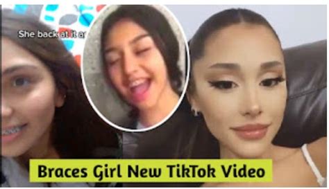 Who Is Braces Girl New Video Story Of Braces Girls Viral On Twitter By Brooke Monk Mar