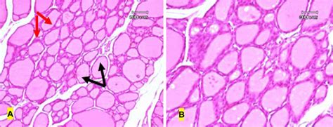 Photomicrograph Of A Section Of The Thyroid Gland Of The Rat A Control