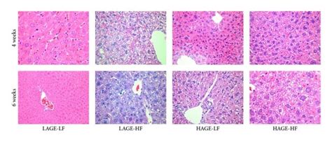 Hematoxylin And Eosin Staining Of Liver Tissues Showing Normal