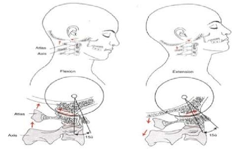 Atlanto Occipital Joint - slidesharetrick