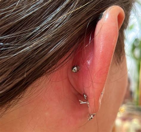 Meu Piercing Inflamou E Agora Carol Tannure