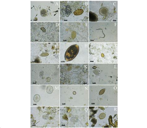 Morphotypes Of Helminths Eggs In 400 X A To F H To S And 1000 X G