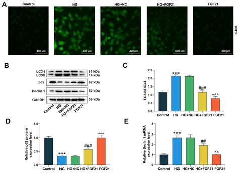 Gata Fgf Axis Regulates The Effects Of High Glucose On The Apoptosis