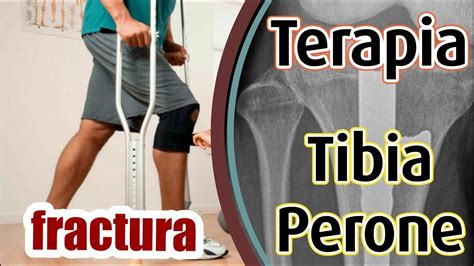 Terapia Fractura Tibia Y Perone Ejercicios Rehabilitacion Youtube