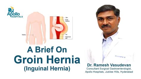 Lump Near Pubic Bone Groin Hernia Dr Ramesh Vasudevan Gastric Surgeon Apollo Hospitals