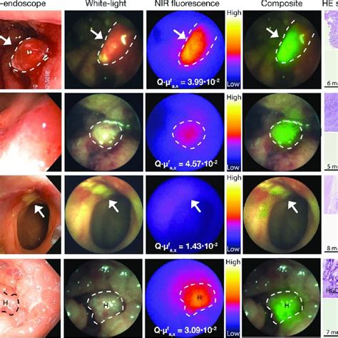 A D Representative Images Of The Quantitative Fluorescence Endoscopy