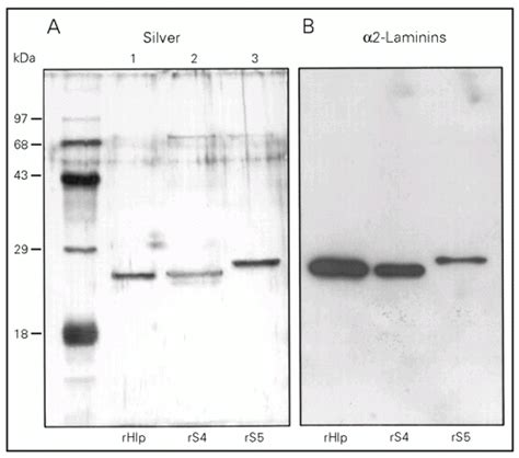 Scielo Brasil Further Biochemical Characterization Of Mycobacterium