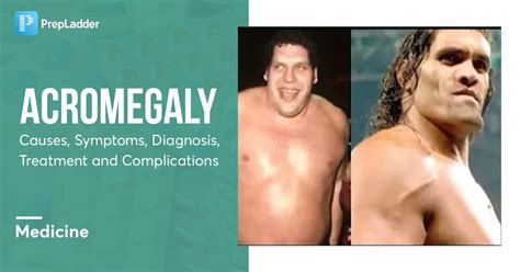 Acromegaly: Causes, Symptoms, Risk Factors, Diagnosis, Treatment and ...