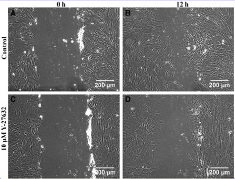 Comparison Of Wound Induced Migration Between Control And Y 27632 Download Scientific Diagram