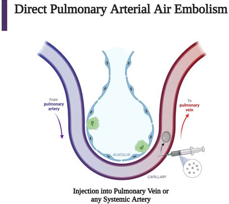 Frontiers Iatrogenic Air Embolism Pathoanatomy Thromboinflammation