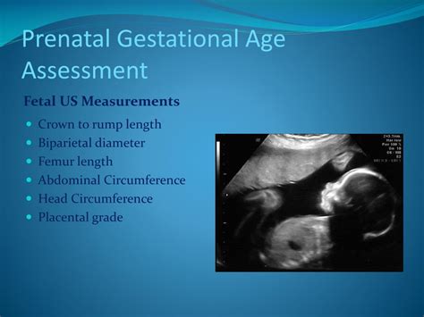 Ppt Neonatal Gestational Age Assessment Powerpoint Presentation Free