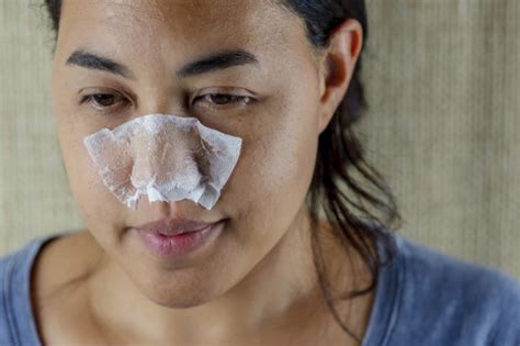 5 Minute Diy Pore Strips To Remove Blackheads